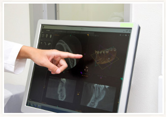 歯科用ＣＴ