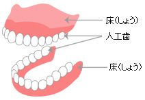 一般的な総入れ歯